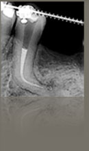 Endodontia microscópica digital