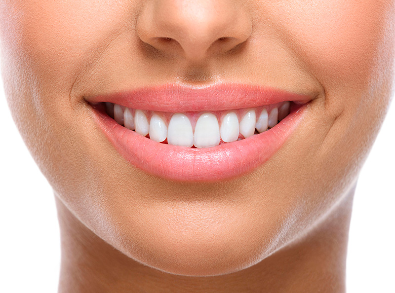 Sorriso em tratamento a laser na odontologia