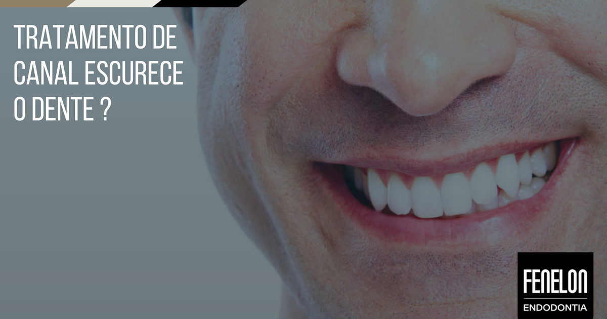 Tratamento de canal escurece o dente?