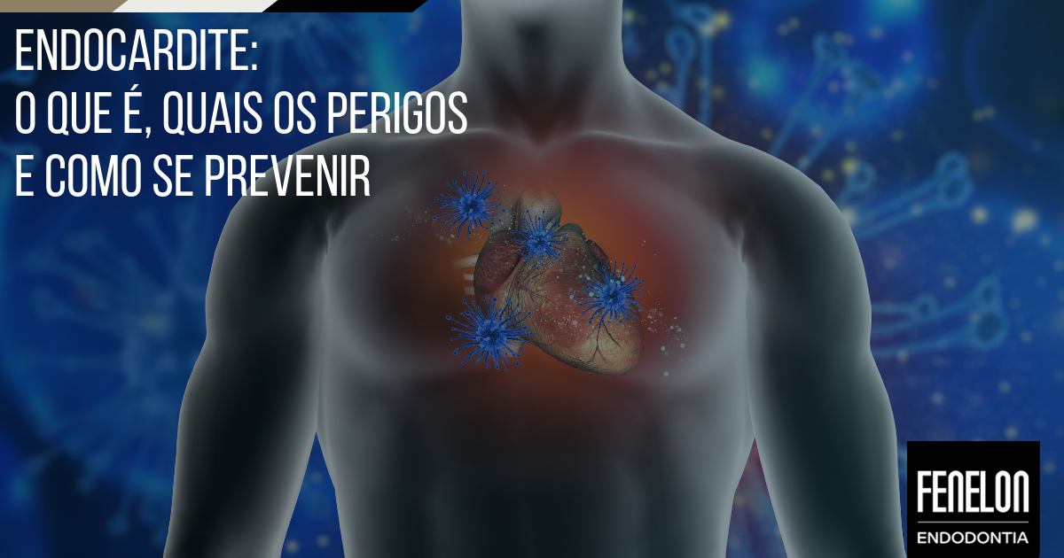 Endocardite: o que é, perigos e como prevenir